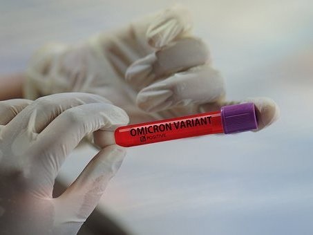 В России зарегистрирована тест-система для выявления нового коронавирусного штамма — «омикрон»